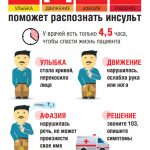 Инсульт